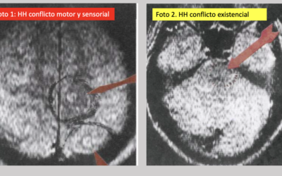 Epilepsia: el caso de Papá Noel.